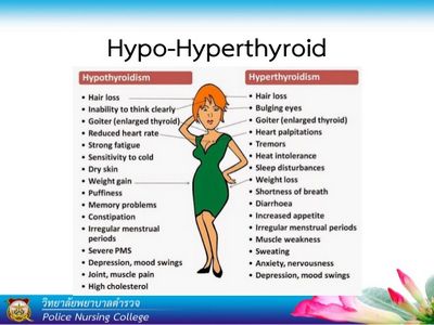 อาการของ Hyperthyroidism